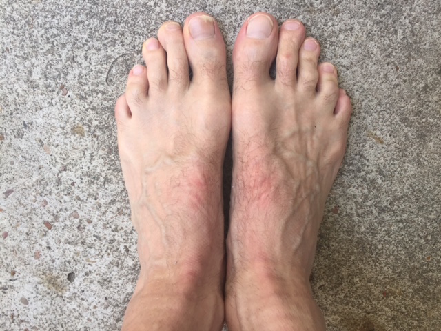Fizik R1 Umo pressure points